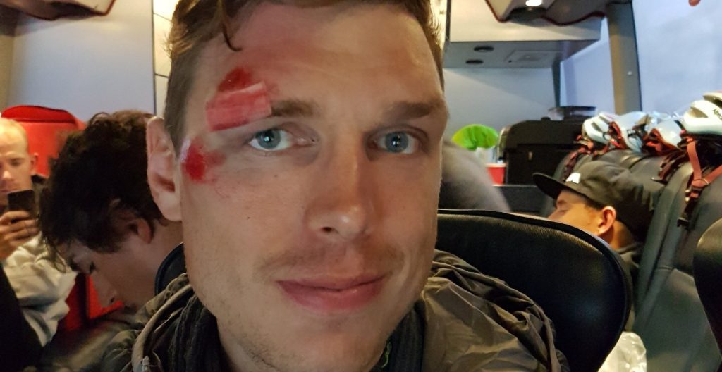 Acht hechtingen in wenkbrauw Tony Martin