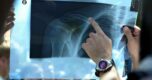 Ploegen in de clinch met Tour de France over CT-scanner